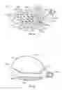 Fig. 32 - Golf club head