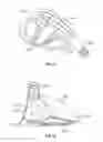 Fig. 33 - Golf club head