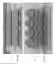 Fig. 45 - Microfluidic tissue development systems
