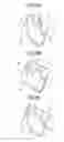 Fig. 08 - ELBOW FORMED BY CUTTING AND METHOD FOR MANUFACTURING SAME