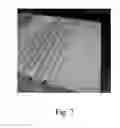 Fig. 08 - Welded, Laminated Apparatus, Methods of Making, and Methods of Using the Apparatus