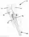 Fig. 01 - Brake spreader tool