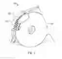 Fig. 02 - Transmissions with retention noses
