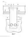 Fig. 04 - Dual rubber body mount