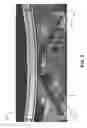 Fig. 06 - Automobile front upper body stablizer