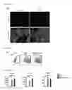 Fig. 04 - METHOD FOR PRODUCING CARDIAC PRECURSOR CELL AND MYOCARDIAL CELL FROM PLURIPOTENT STEM CELL