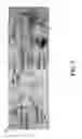 Fig. 07 - Capillary barriers for staged loading of microfluidic devices