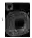 Fig. 02 - Preventing tumor development and metastasis