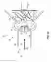 Fig. 04 - Systems and method for a variable inlet device of a compressor
