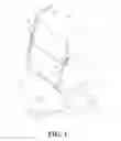 Fig. 02 - Adjustable bracket for accessory attachment on strut