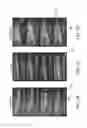 Fig. 03 - Hydrogel encapsulation of living organisms for long-term microscopy