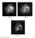 Fig. 07 - Device and method for imaging shortwave infrared fluorescence