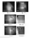 Fig. 08 - Device and method for imaging shortwave infrared fluorescence