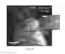 Fig. 09 - Device and method for imaging shortwave infrared fluorescence