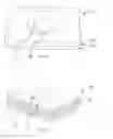 Fig. 02 - Assay and kit for detection of endotoxin