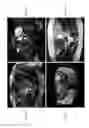 Fig. 08 - Free-breathing 3D body diffusion imaging using motion-compensated diffusion preparation and motion robust readout