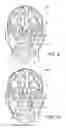 Fig. 07 - Vein matching for difficult biometric authentication cases