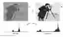 Fig. 01 - Artifact detection in a contrast enhanced output image