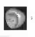 Fig. 06 - Motion management in image-guided radiotherapy using contour elements