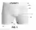 Fig. 02 - Garment with enhanced stretch feature