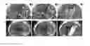 Fig. 01 - METHOD FOR THE DETECTION AND STAGING OF LIVER FIBROSIS FROM IMAGE ACQUIRED DATA