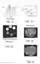 Fig. 02 - Innate metabolic imaging of cellular systems