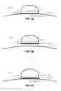 Fig. 06 - System and method for detecting decoupling of an auscultatory sound sensor from a test-subject