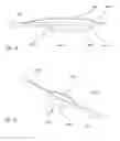 Fig. 07 - ULTRASONIC CONTROL FOR INTRAVASCULAR TISSUE DISRUPTION