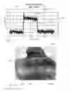 Fig. 09 - ULTRASONIC CONTROL FOR INTRAVASCULAR TISSUE DISRUPTION