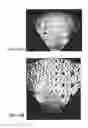Fig. 09 - Method and apparatus to produce ultrasonic images using multiple apertures
