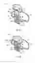 Fig. 07 - System having anchored interface for shaping and positioning a tissue body