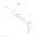 Fig. 02 - Medical retractor