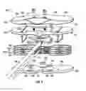 Fig. 04 - ACTUATED POSITIONING DEVICE FOR ARTHROPLASTY AND METHODS OF USE