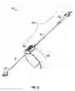 Fig. 08 - ACTUATED POSITIONING DEVICE FOR ARTHROPLASTY AND METHODS OF USE