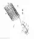 Fig. 12 - Tissue anchors with hemostasis seal