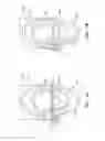 Fig. 13 - Tissue anchors with hemostasis seal