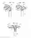 Fig. 24 - Tissue anchors with hemostasis seal