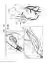Fig. 29 - Tissue anchors with hemostasis seal