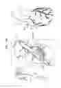 Fig. 30 - Tissue anchors with hemostasis seal