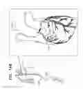 Fig. 31 - Tissue anchors with hemostasis seal
