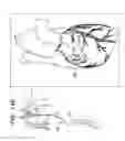 Fig. 32 - Tissue anchors with hemostasis seal