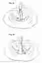 Fig. 08 - SURGICAL STABILIZER