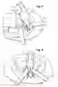 Fig. 09 - SURGICAL STABILIZER