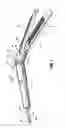Fig. 02 - Tool assembly for a surgical stapling device