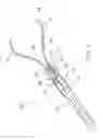 Fig. 02 - Device and Method for Through the Scope Endoscopic Hemostatic Clipping