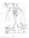 Fig. 02 - Aortic occlusion device