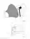 Fig. 06 - Surgical instruments with multi-purpose detachable components