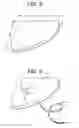 Fig. 03 - Method and devices for a sub-splenius/supra-levator scapulae surgical access technique