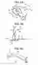 Fig. 07 - Method and devices for a sub-splenius/supra-levator scapulae surgical access technique