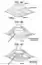 Fig. 09 - Method and devices for a sub-splenius/supra-levator scapulae surgical access technique